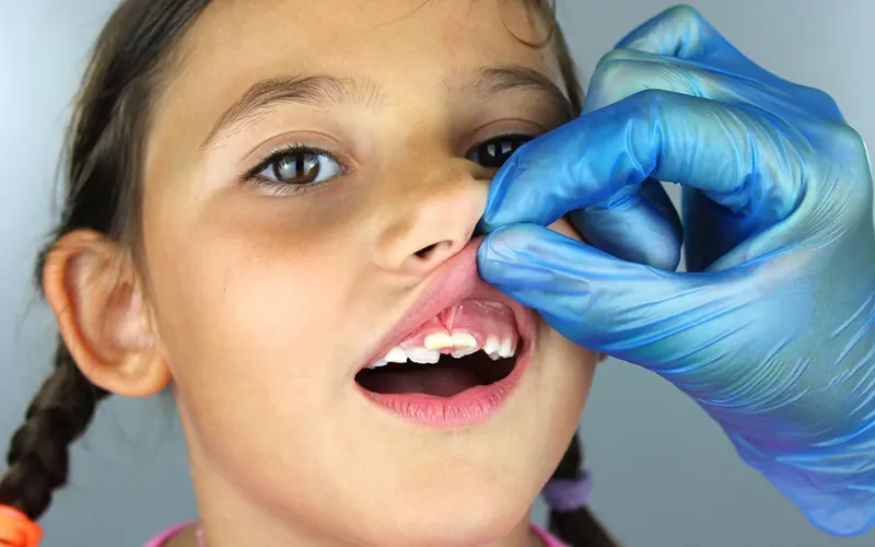 Pédodontie dentiste enfant Casablanca